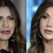 Kristi Noem Before Plastic Surgery