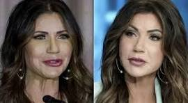 Kristi Noem Before Plastic Surgery